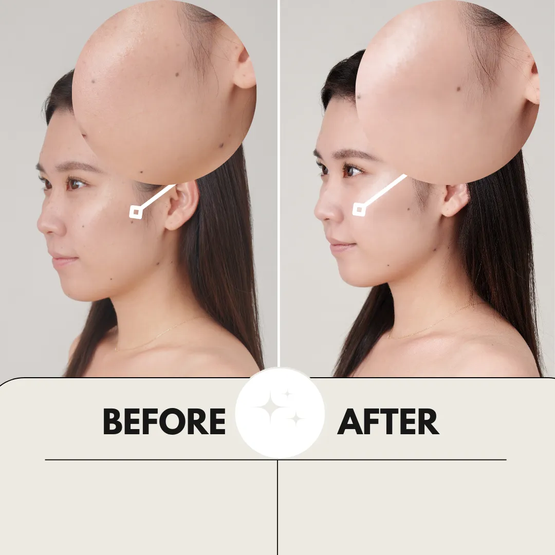All-in-One-White Gel