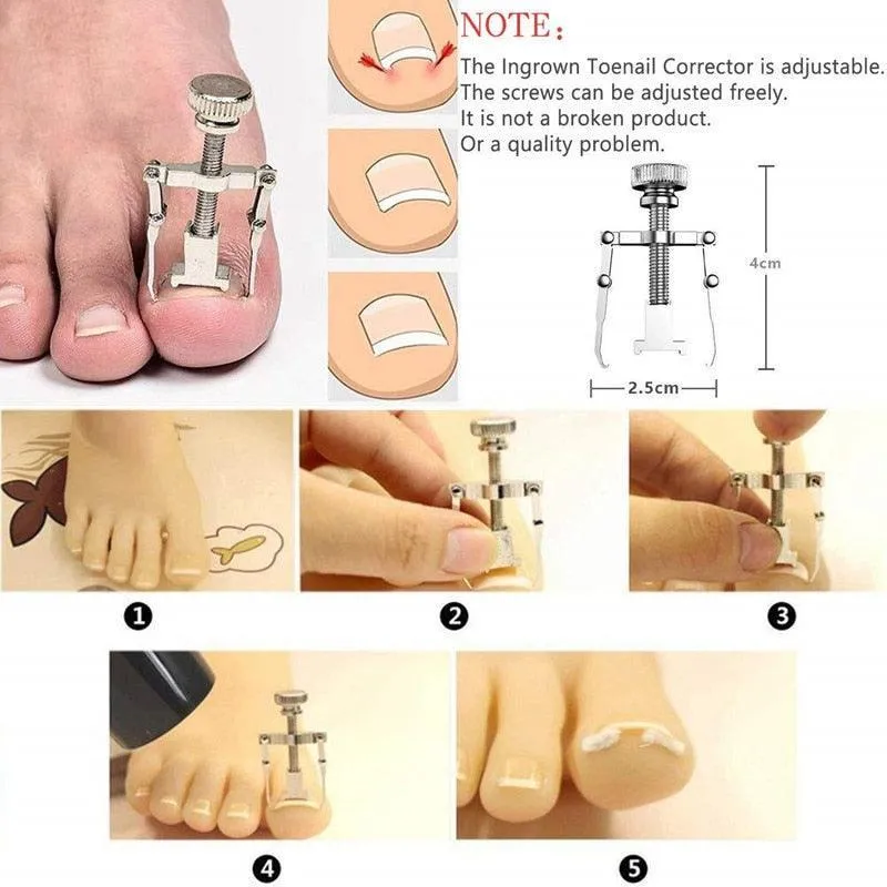 Professional Pedicure Tools Ingrown Toenail Tools Kit Nail Care